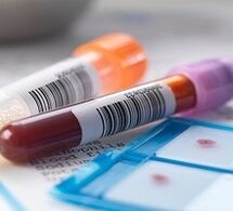 Laboratórna diagnostika prostatitídy