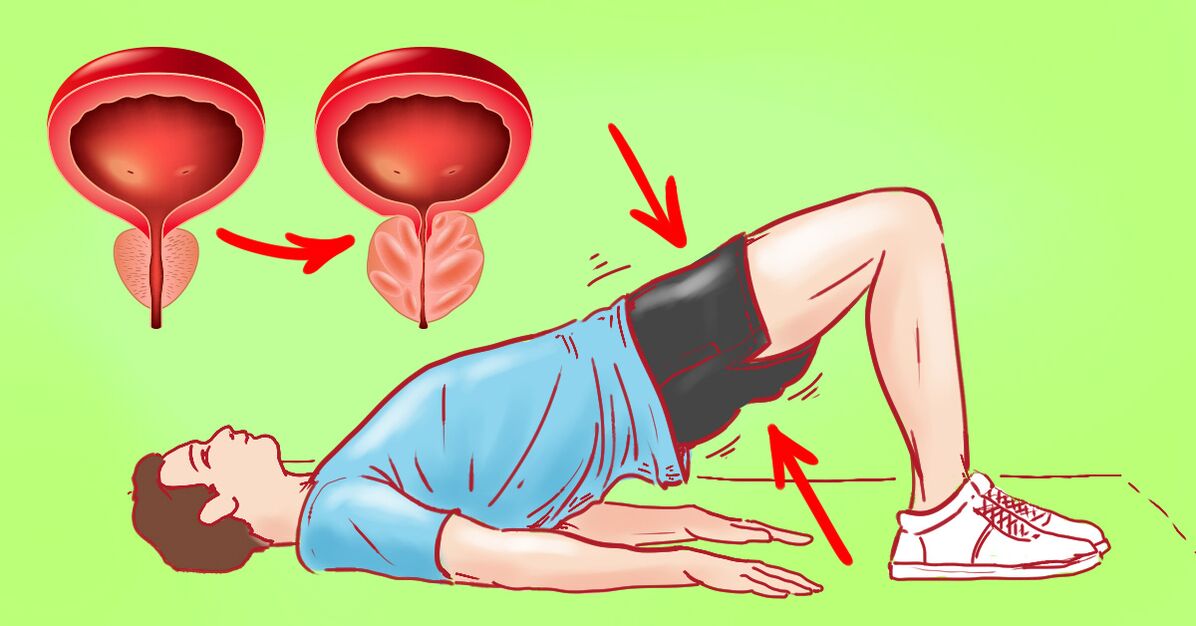 Terapeutické cvičenia na chronickú prostatitídu