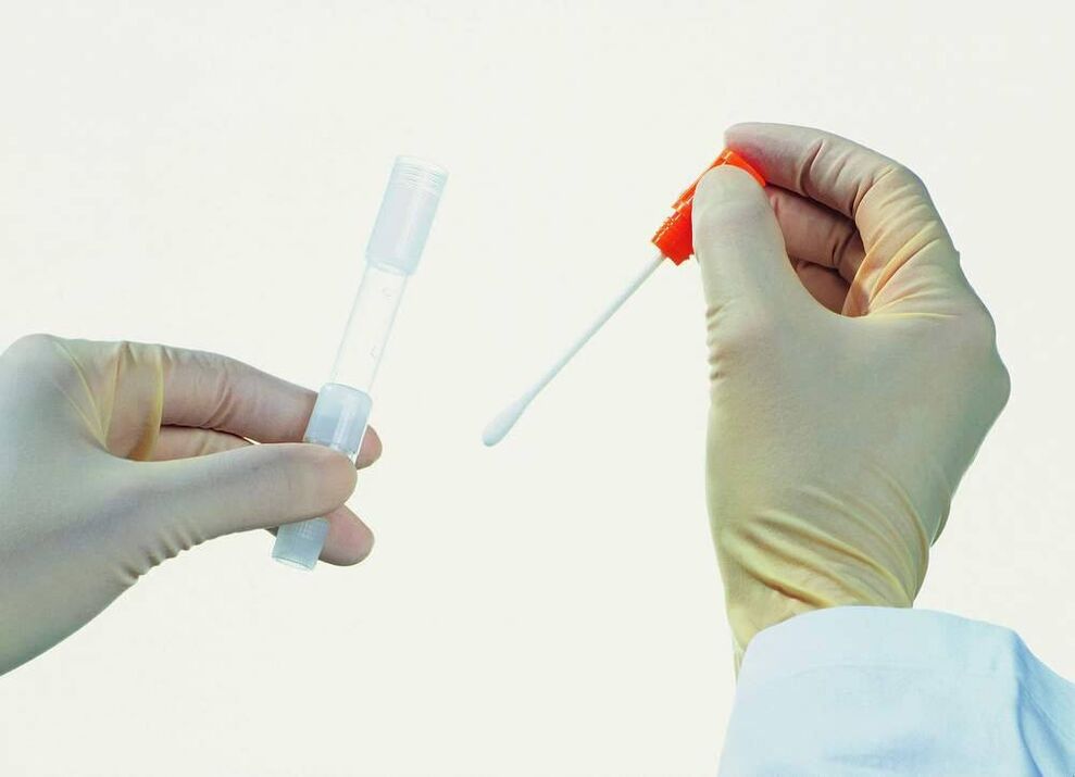 Zbierka analýzy na detekciu chronickej prostatitídy