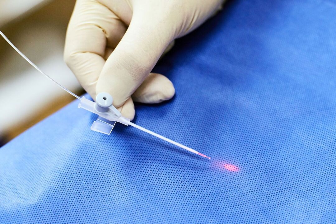 transrektálny prístroj na liečbu prostaty